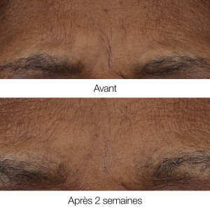 Smart Clinical Repair™ - Anti-Falten-Retinoid-Balsam Smart Clinical Repair™ - Anti-Falten-Retinoid-Balsam